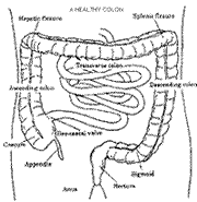 IBS